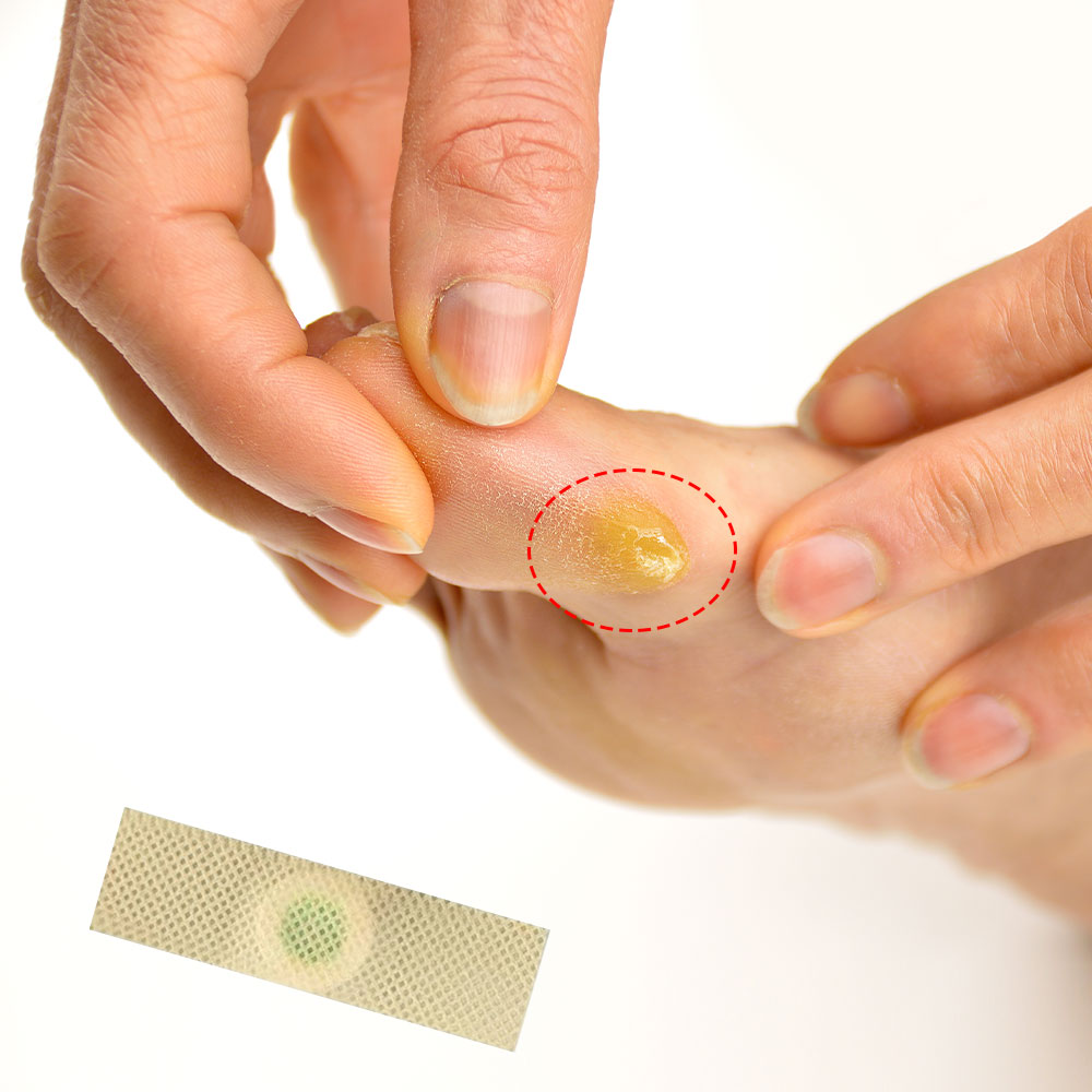 Set di 60 Cerotti Medici per l - Detox Foot Patch recensione e prezzo